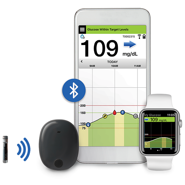 eversense device