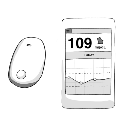 eversense
